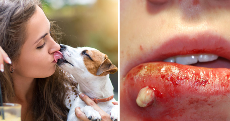 This Is Why You Should Never Let Your Dog Lick Your Mouth Global Today Indya